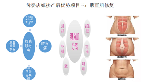 少林永化堂產(chǎn)后項目-腹直肌修復(fù).jpg